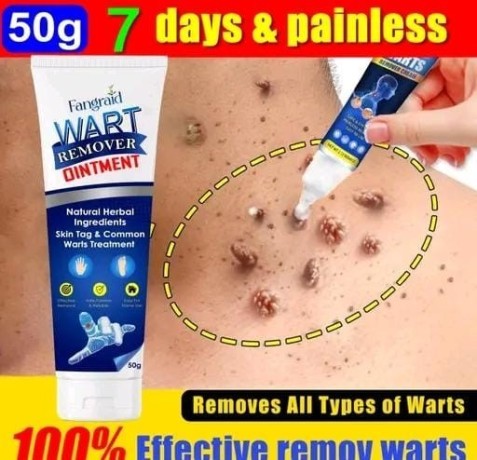 wart-removal-ointment-skin-tag-removal-cream-massa-remover-cream-big-0